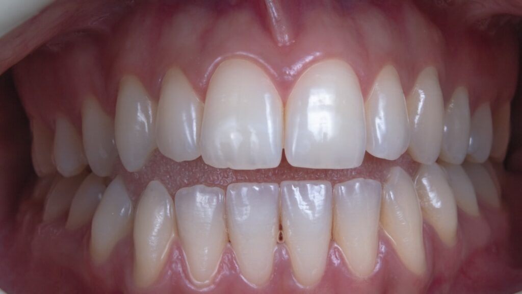 a person's mouth with teeth