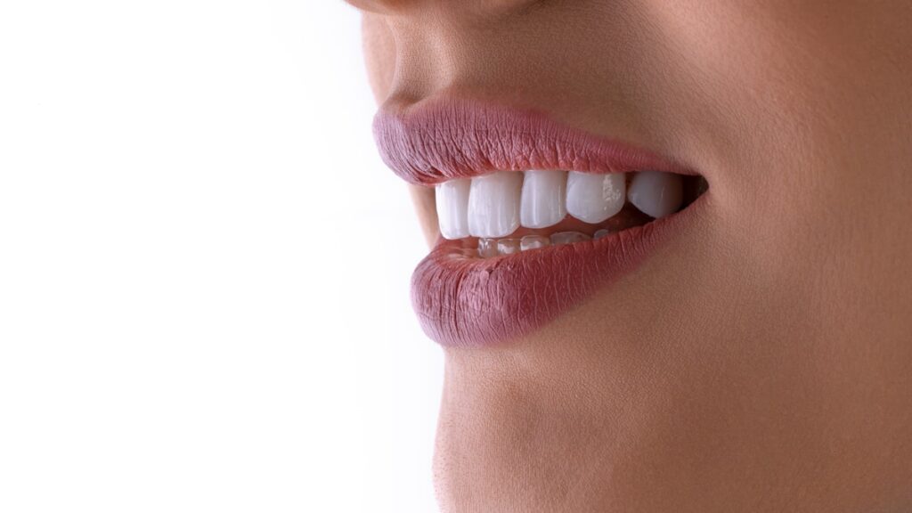 a close up of a woman's mouth with white teeth