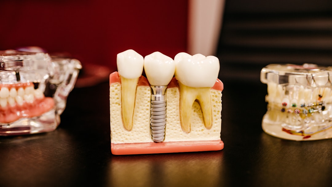 dental implant model with teeth