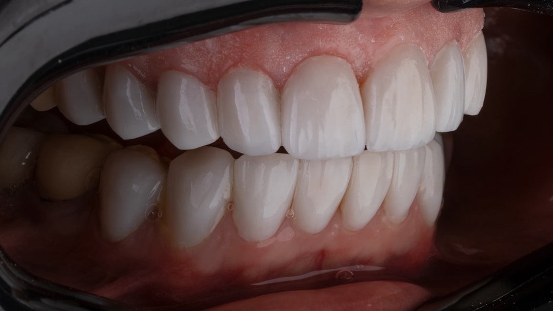 a person's mouth with teeth