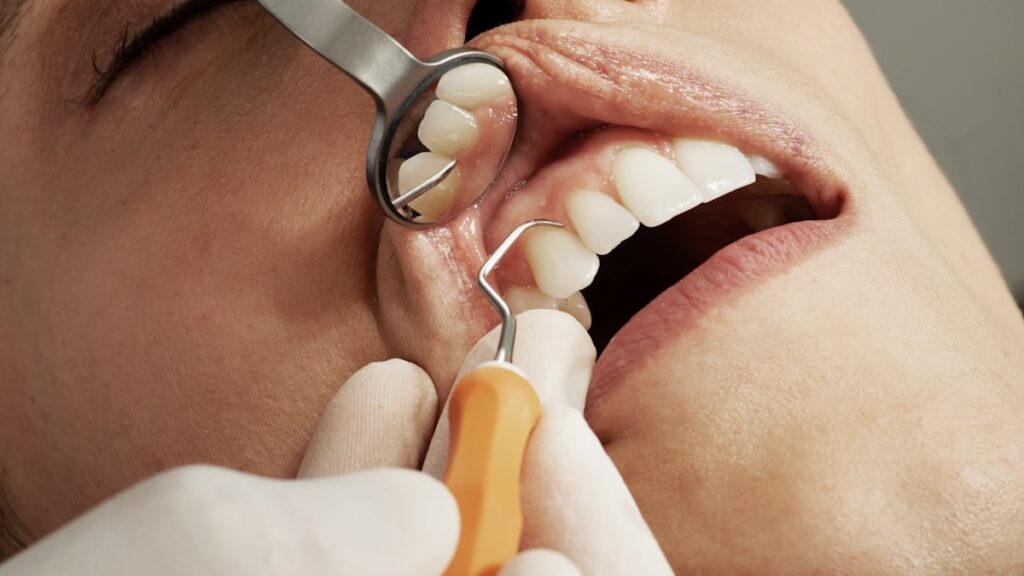 dental exam with mirror and tool